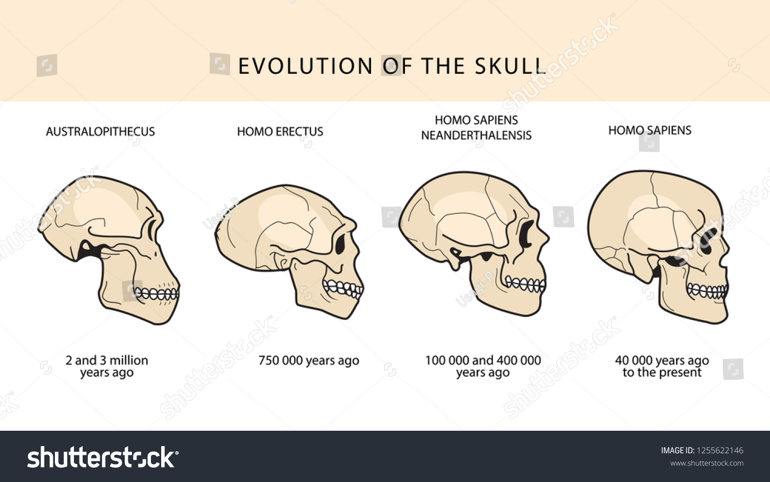 5 Key Features of the Labeled Paranthropus Boisei Skull